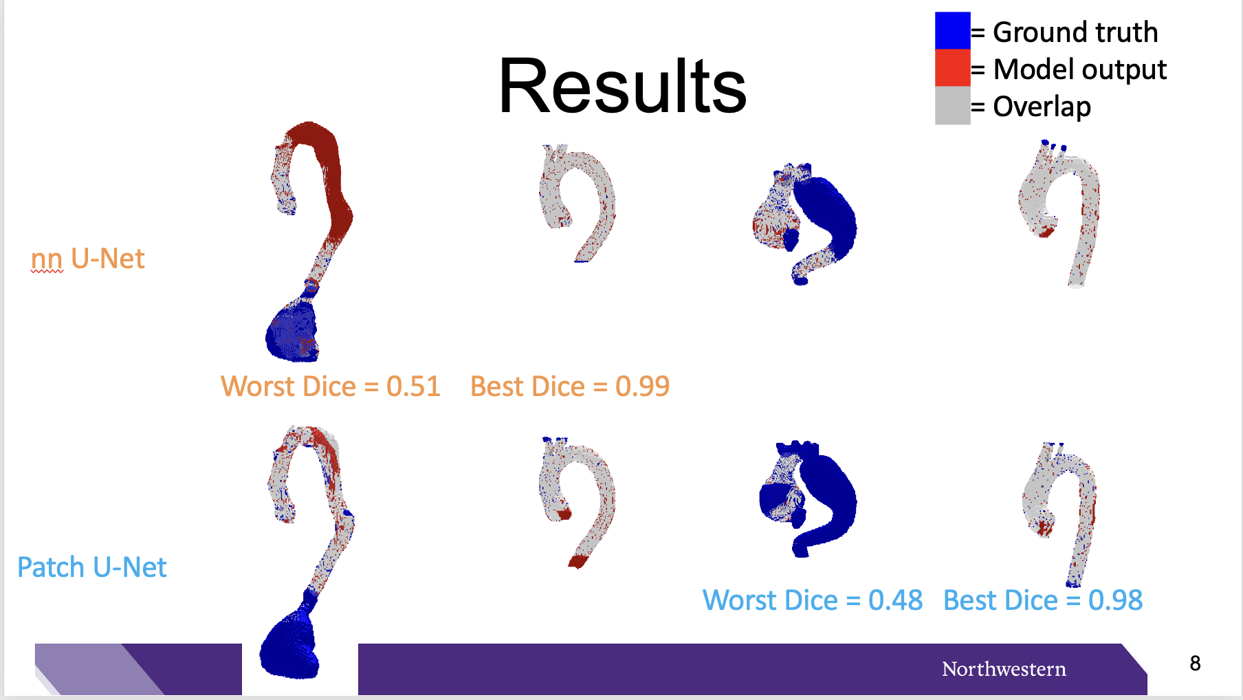 Deep Learning-based Thoracic Aorta Segmentation on Cross-institutional Computed Tomography Angiography Images thumbnail