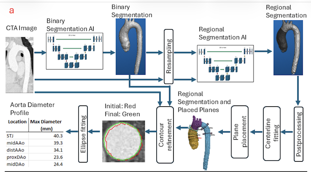 Fully Automated Multisite Deep Learning CTA Segmentation and Diameter Quantification thumbnail