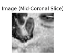 hippocampus_seg thumbnail