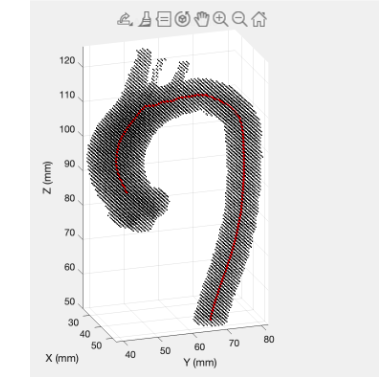 aorta_centerline thumbnail